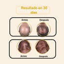 CAPILUX PRO-¡Dile adiós a la caída del cabello y despierta el crecimiento natural!