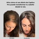 CAPILUX PRO-¡Dile adiós a la caída del cabello y despierta el crecimiento natural!